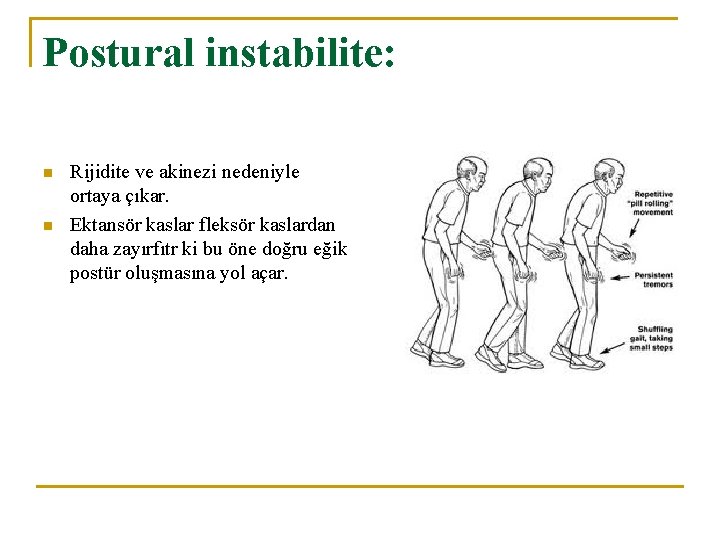 Postural instabilite: n n Rijidite ve akinezi nedeniyle ortaya çıkar. Ektansör kaslar fleksör kaslardan