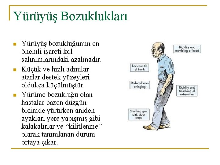 Yürüyüş Bozuklukları n n n Yürüyüş bozukluğunun en önemli işareti kol salınımlarındaki azalmadır. Küçük
