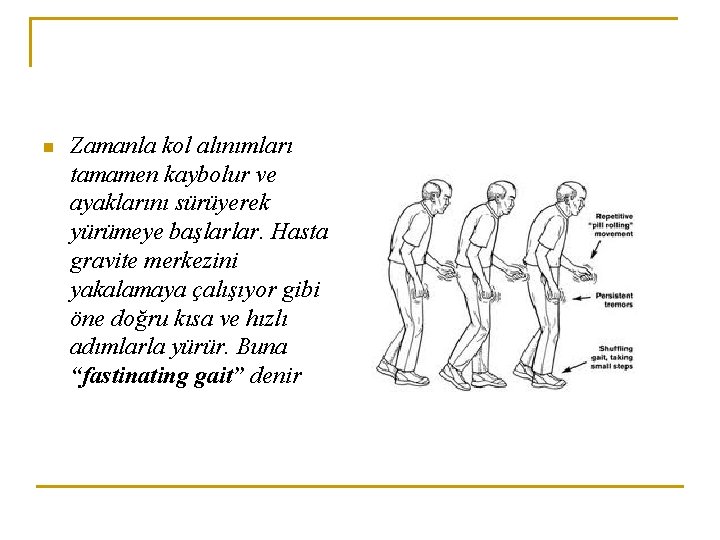 n Zamanla kol alınımları tamamen kaybolur ve ayaklarını sürüyerek yürümeye başlarlar. Hasta gravite merkezini