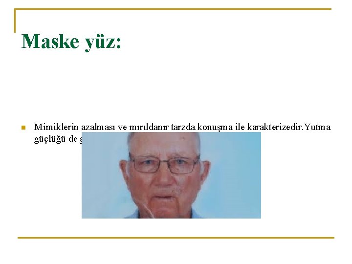 Maske yüz: n Mimiklerin azalması ve mırıldanır tarzda konuşma ile karakterizedir. Yutma güçlüğü de