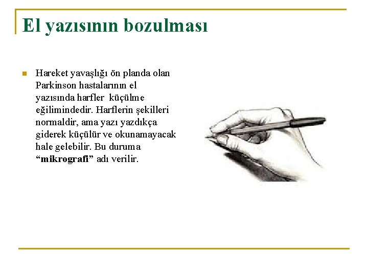 El yazısının bozulması n Hareket yavaşlığı ön planda olan Parkinson hastalarının el yazısında harfler