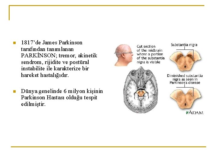 n 1817’de James Parkinson tarafından tanımlanan PARKİNSON; tremor, akinetik sendrom, rijidite ve postüral instabilite