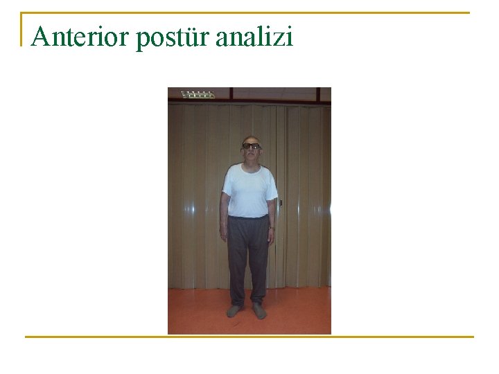 Anterior postür analizi 