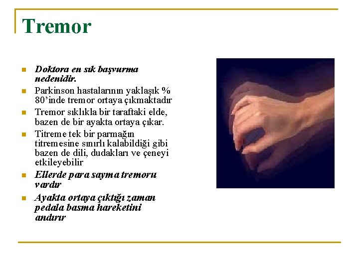 Tremor n n n Doktora en sık başvurma nedenidir. Parkinson hastalarının yaklaşık % 80’inde
