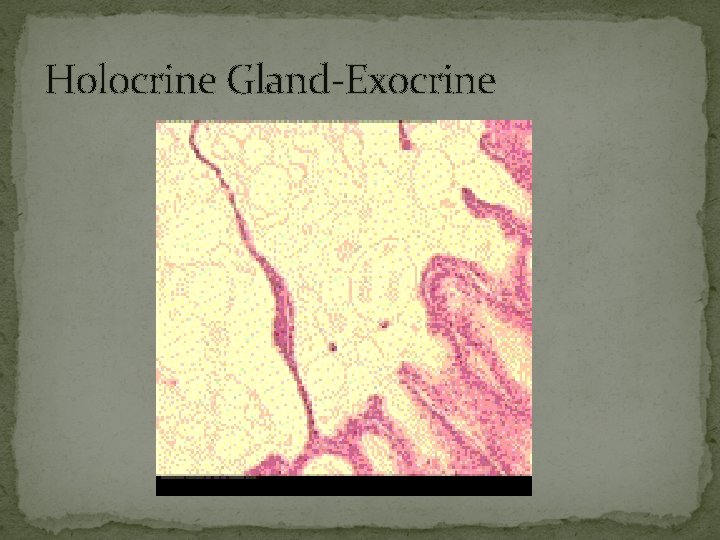 Holocrine Gland-Exocrine 