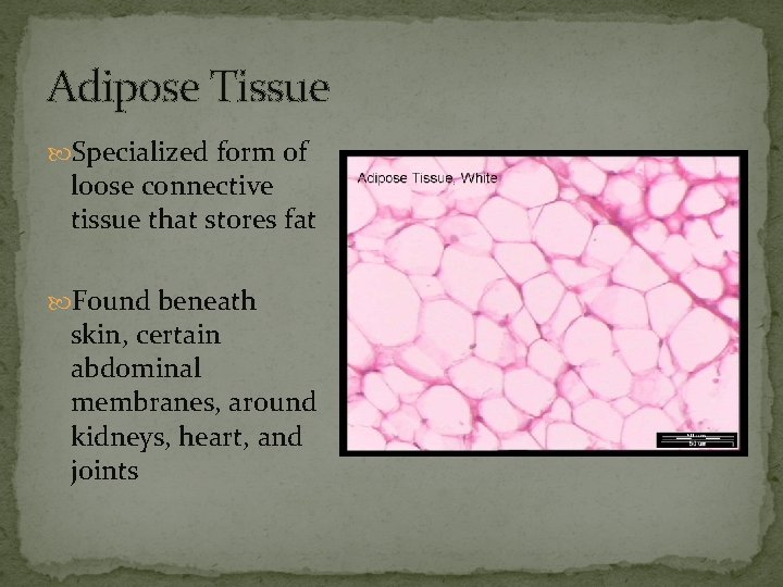 Adipose Tissue Specialized form of loose connective tissue that stores fat Found beneath skin,