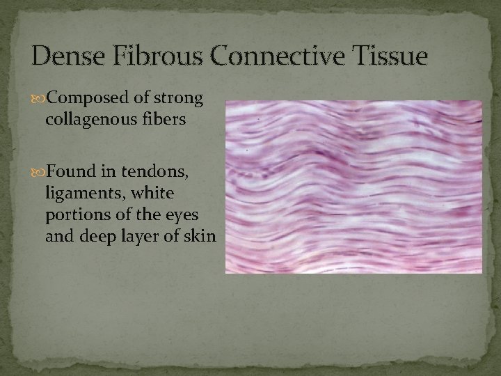 Dense Fibrous Connective Tissue Composed of strong collagenous fibers Found in tendons, ligaments, white
