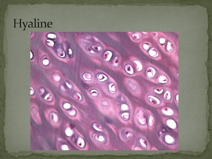 Hyaline 