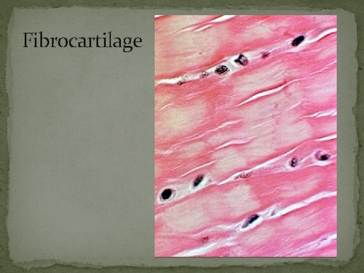 Fibrocartilage 