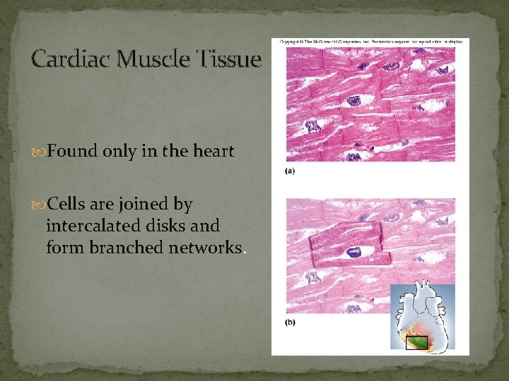 Cardiac Muscle Tissue Found only in the heart Cells are joined by intercalated disks