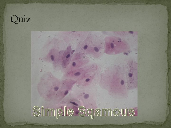Quiz Simple Sqamous 