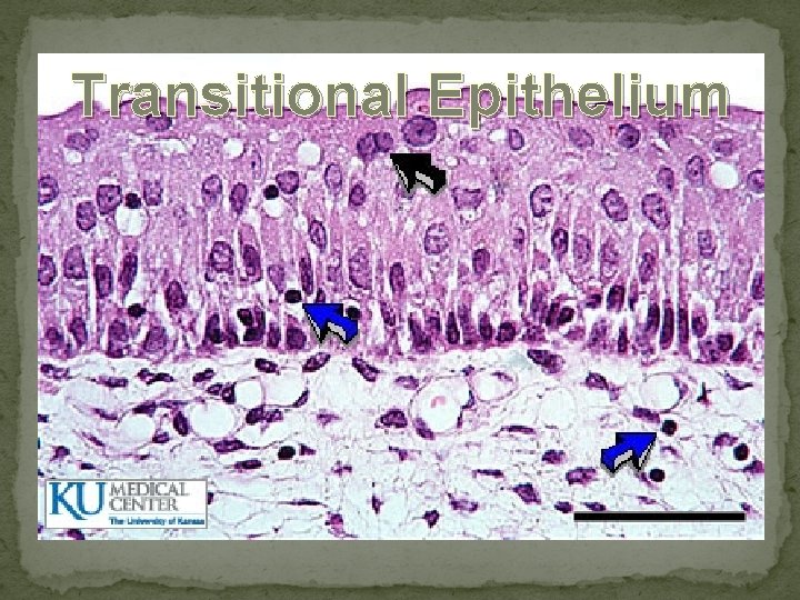 Transitional Epithelium 