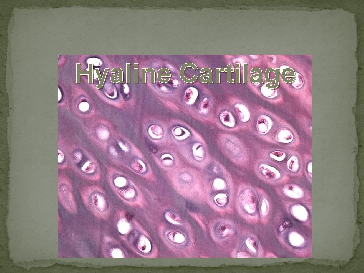 Hyaline Cartilage 