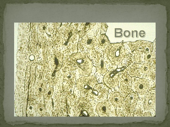 Bone 