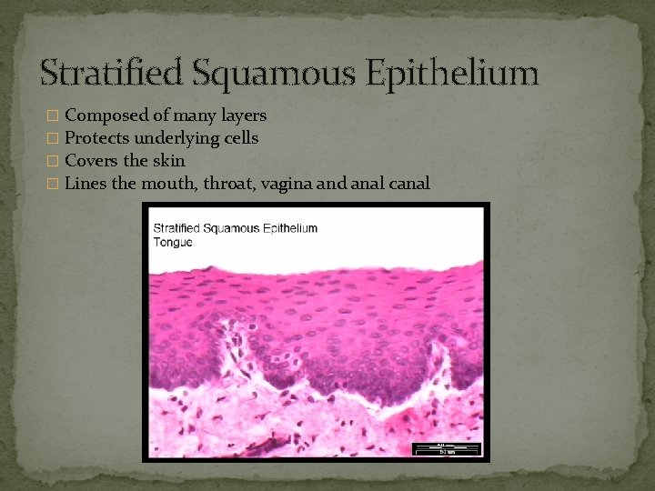 Stratified Squamous Epithelium � Composed of many layers � Protects underlying cells � Covers