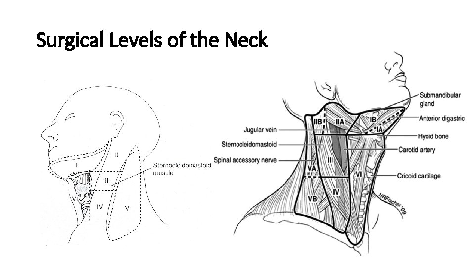 Surgical Levels of the Neck 