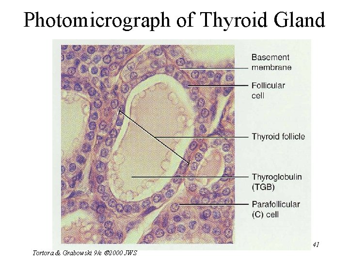 Photomicrograph of Thyroid Gland Tortora & Grabowski 9/e 2000 JWS 41 