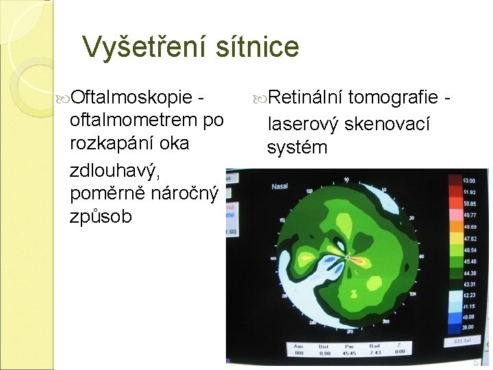 Vyšetření sítnice Oftalmoskopie oftalmometrem po rozkapání oka zdlouhavý, poměrně náročný způsob Retinální tomografie laserový