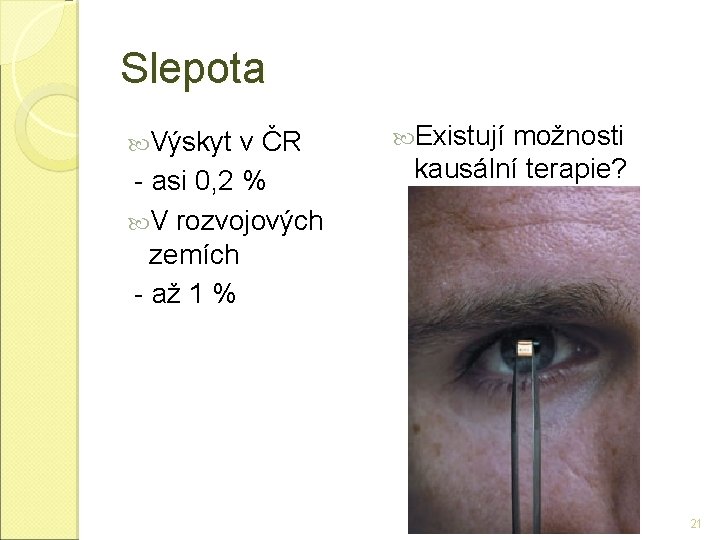 Slepota Výskyt v ČR - asi 0, 2 % V rozvojových zemích - až