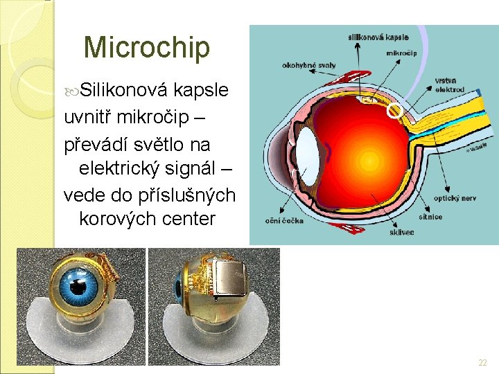 Microchip Silikonová kapsle uvnitř mikročip – převádí světlo na elektrický signál – vede do