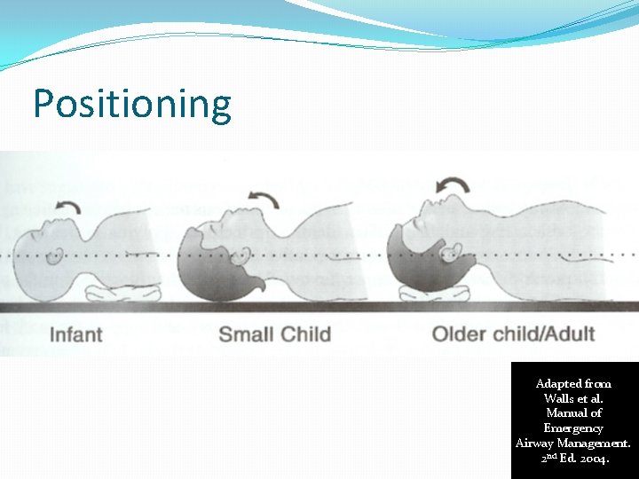 Positioning Adapted from Walls et al. Manual of Emergency Airway Management. 2 nd Ed.