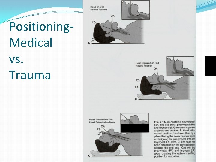 Positioning. Medical vs. Trauma 