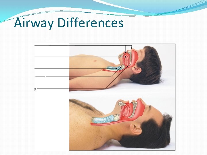 Airway Differences Nose Tongue Trachea Cricoid Airway 