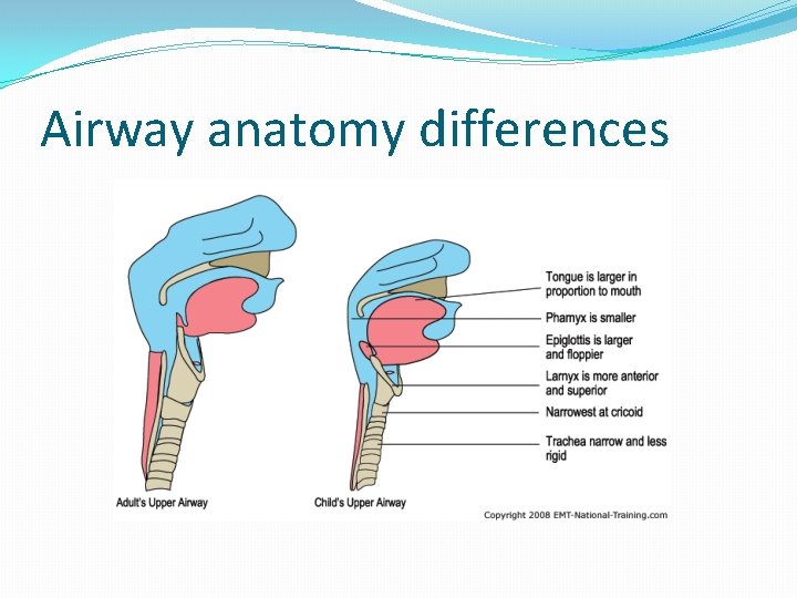 Airway anatomy differences 