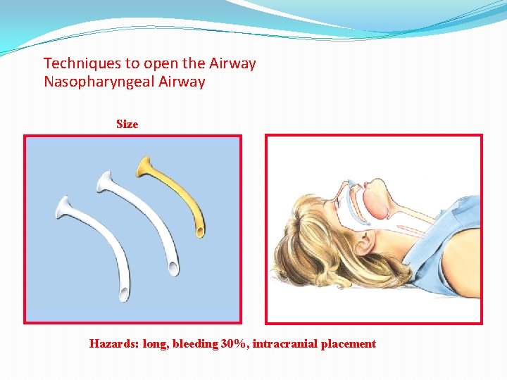 Techniques to open the Airway Nasopharyngeal Airway Size Hazards: long, bleeding 30%, intracranial placement