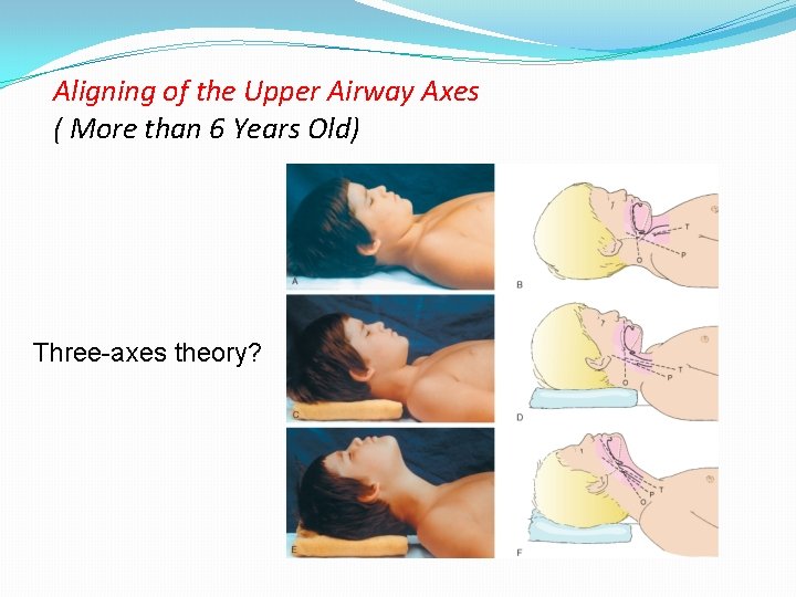 Aligning of the Upper Airway Axes ( More than 6 Years Old) Three-axes theory?