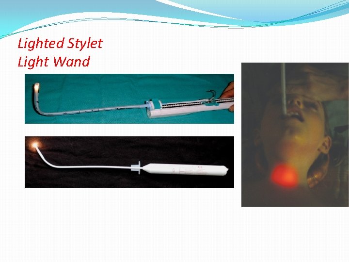 Lighted Stylet Light Wand 