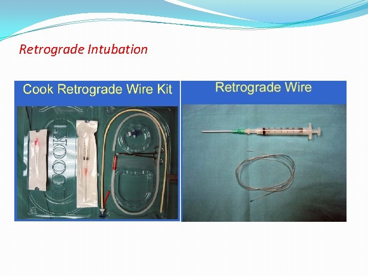 Retrograde Intubation 