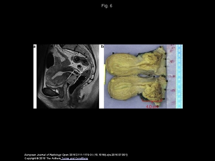 Fig. 6 European Journal of Radiology Open 2015 2111 -117 DOI: (10. 1016/j. ejro.