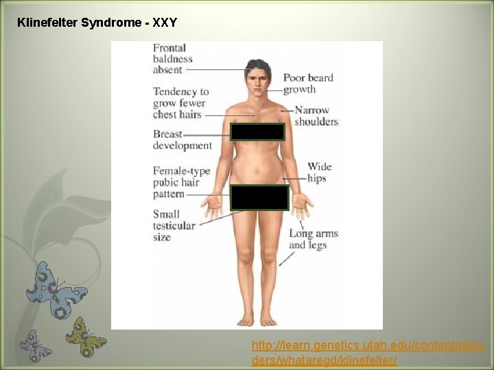 Klinefelter Syndrome - XXY http: //learn. genetics. utah. edu/content/disor ders/whataregd/klinefelter/ 