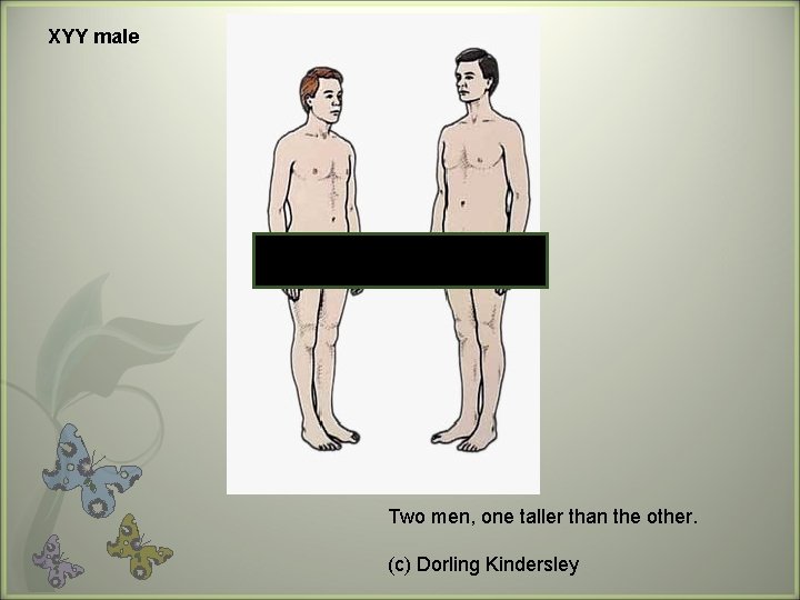 XYY male Two men, one taller than the other. (c) Dorling Kindersley 