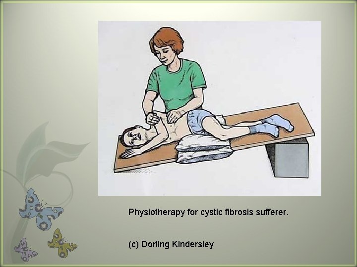 Physiotherapy for cystic fibrosis sufferer. (c) Dorling Kindersley 