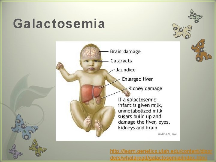 Galactosemia http: //learn. genetics. utah. edu/content/disor ders/whataregd/galactosemia/index. html 