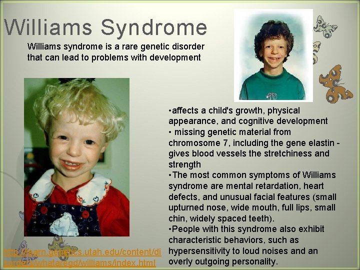 Williams Syndrome Williams syndrome is a rare genetic disorder that can lead to problems
