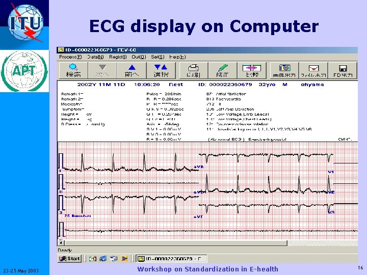 ECG display on Computer ITU-T 23 -25 May 2003 Workshop on Standardization in E-health