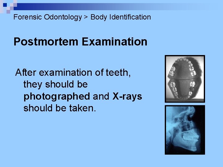 Forensic Odontology > Body Identification Postmortem Examination After examination of teeth, they should be