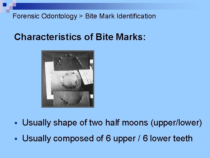 Forensic Odontology > Bite Mark Identification Characteristics of Bite Marks: § Usually shape of