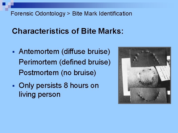 Forensic Odontology > Bite Mark Identification Characteristics of Bite Marks: § Antemortem (diffuse bruise)