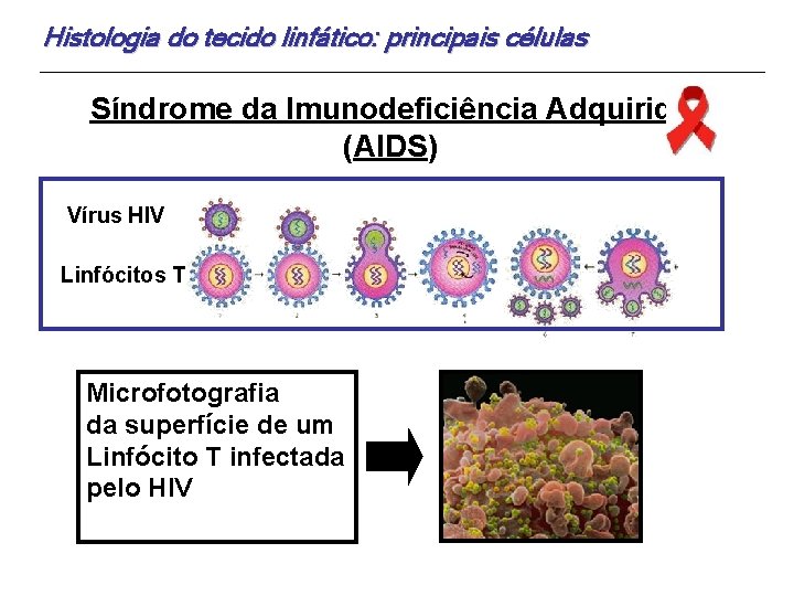 Histologia do tecido linfático: principais células Síndrome da Imunodeficiência Adquirida (AIDS) Vírus HIV Linfócitos