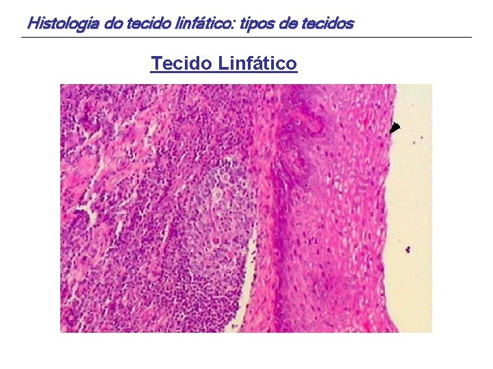 Histologia do tecido linfático: tipos de tecidos Tecido Linfático 