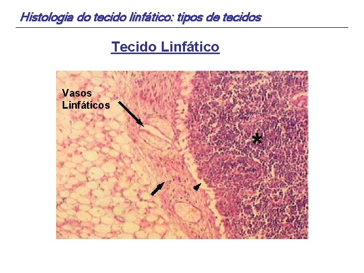 Histologia do tecido linfático: tipos de tecidos Tecido Linfático Vasos Linfáticos 