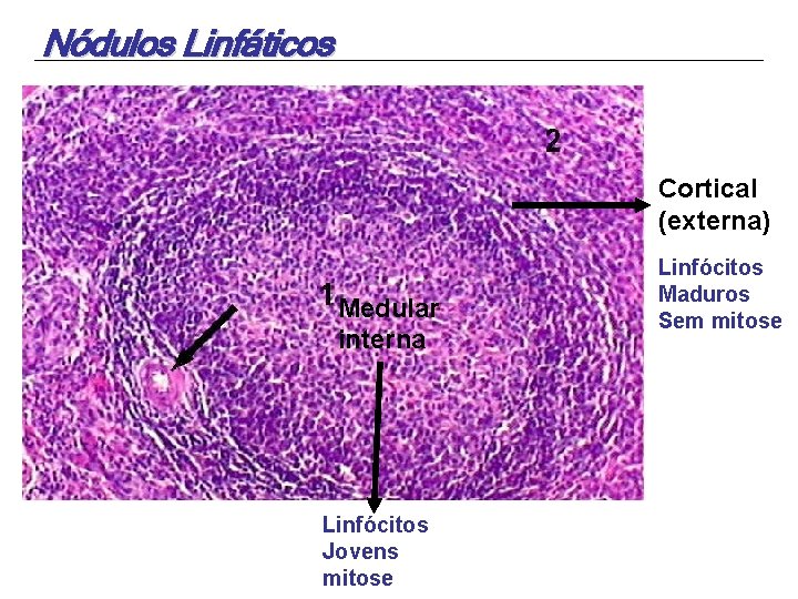 Nódulos Linfáticos Cortical (externa) Medular interna Linfócitos Jovens mitose Linfócitos Maduros Sem mitose 