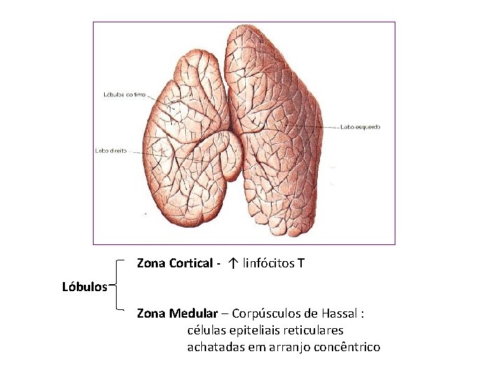 Zona Cortical - ↑ linfócitos T Lóbulos Zona Medular – Corpúsculos de Hassal :