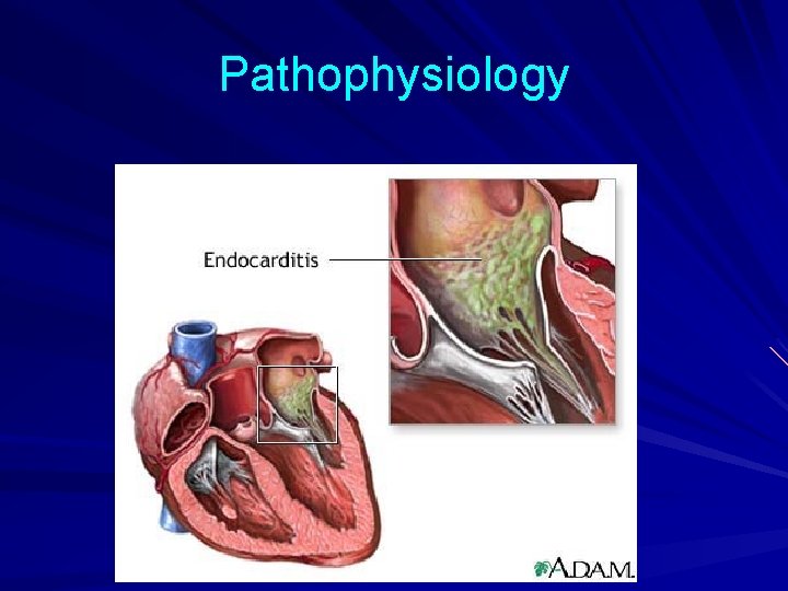 Pathophysiology 