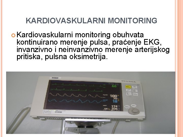 KARDIOVASKULARNI MONITORING Kardiovaskularni monitoring obuhvata kontinuirano merenje pulsa, praćenje EKG, invanzivno i neinvanzivno merenje KARDIOVASKULARNI MONITORING Kardiovaskularni monitoring obuhvata kontinuirano merenje pulsa, praćenje EKG, invanzivno i neinvanzivno merenje