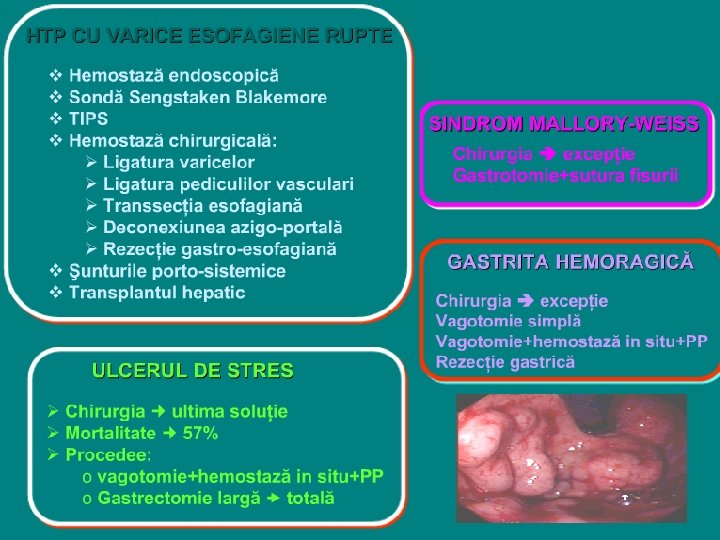 mortalitate varicoza